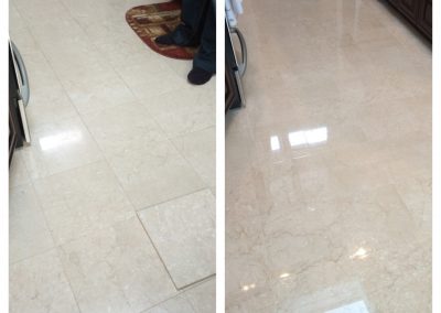 Before and after nyc stone care